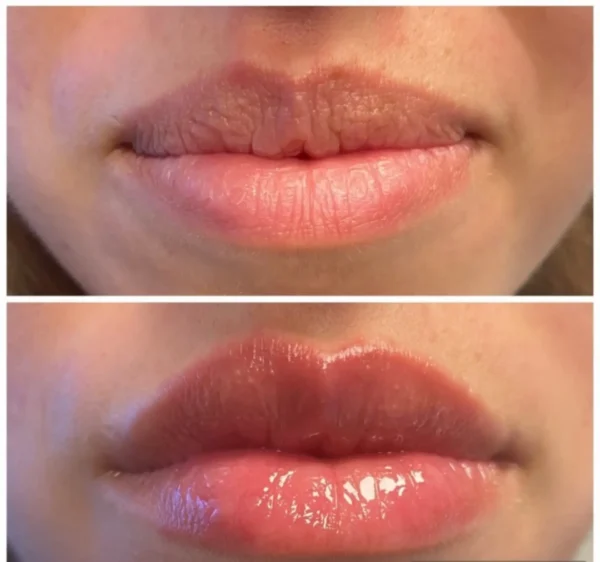 ⁦גלוס משנה גוון ומנפח שפתיים Lips Bomb⁩ – תמונה ⁦6⁩
